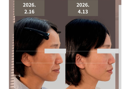 美容鍼灸サロン マックスビューティーのこだわりポイント