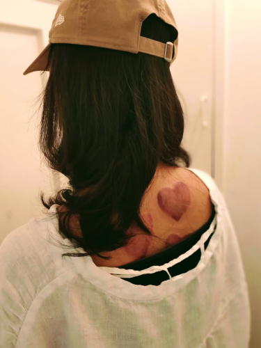 im.Hari™イムハリ全身美容鍼 Body+Beauty Facial Acupuncture 府中のこだわりポイント