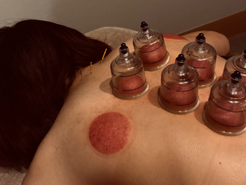 取〼鍼灸按摩施術処のこだわりポイント