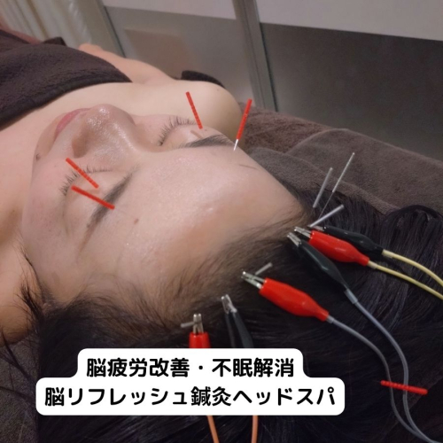 Well-beプラーカ鍼灸室のこだわりポイント