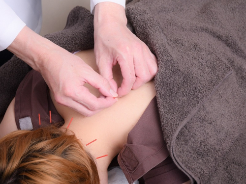 薄毛・抜け毛専門の鍼灸治療院レメディのこだわりポイント