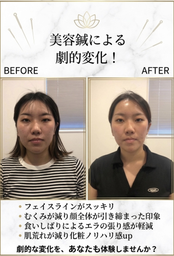 ライト鍼灸院のこだわりポイント