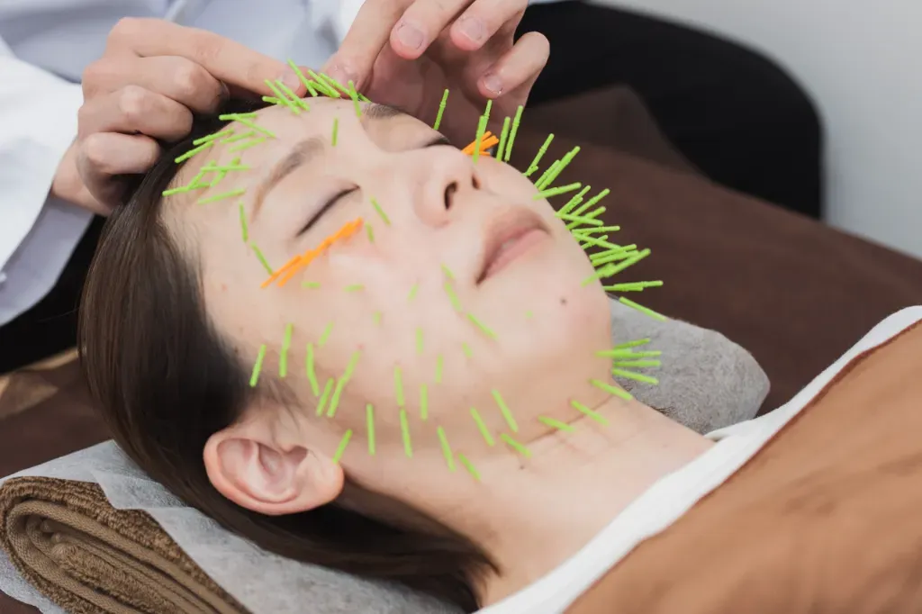 肌質改善専門 美容鍼デイジー相模原店のこだわりポイント