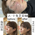 鍼処NANGAKUDO-南学堂-@兵庫県・尼崎市ルート治療認定院