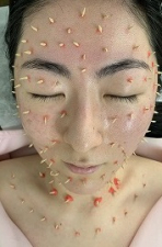 東松原駅周辺のおすすめの鍼灸院 美容鍼サロン しんきゅうコンパス