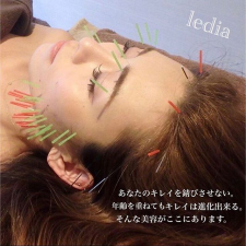 美容鍼　ledia（ルディア）堂島店