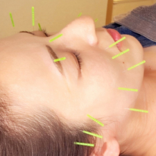 美容鍼専用 鍼灸サロン Ruana