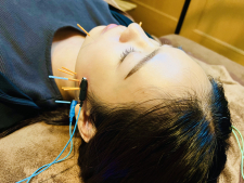 ノブ鍼灸salon