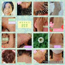 はりきゅう治療室ほのか
