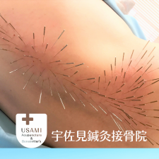宇佐見鍼灸接骨院