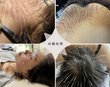 光鍼灸院