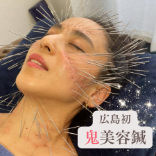 月陽堂鍼灸治療院