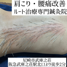 鍼処NANGAKUDO-南学堂-@兵庫県・尼崎市ルート治療認定院