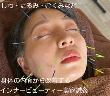 鍼灸サロンLieN