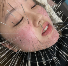 たまがわ鍼灸院(ルート治療)