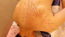 ゴスペル鍼療院