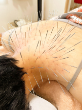 ルート鍼灸治療院ほむら