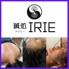 鍼処 IRIE （アイリー）　〜ルート治療専門〜