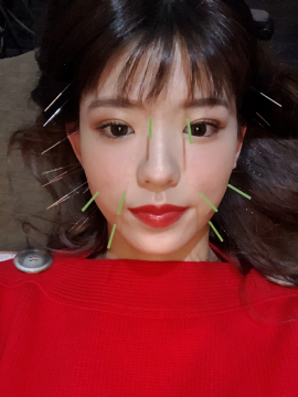 美容鍼jasmine 神戸市周辺の鍼灸院