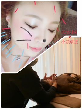 My Art 鍼灸整骨院 京橋 obp 森之宮の鍼灸院