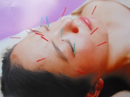 恵比寿鍼灸整骨院 美容鍼のメニュー画像