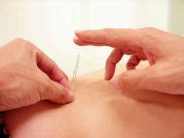 山下鍼灸院 治療料金のメニュー画像