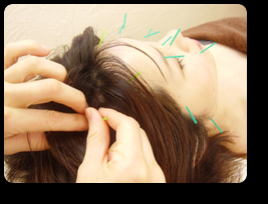 ヒーリングセンターヘルメス 美容鍼灸のメニュー画像