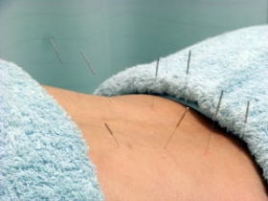 おおぞら葛西針灸整骨院 本院 針治療(自費治療のメニュー画像