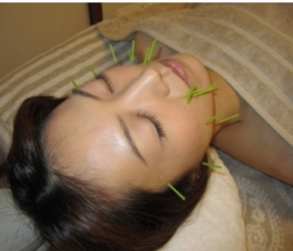 美容鍼灸専門サロンkoko 美容鍼灸 のメニュー画像