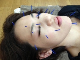 はりきゅう院 たなこころ 美顔鍼のメニュー画像