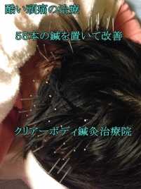 クリアーボディ鍼灸治療院 鍼灸【初診】のメニュー画像