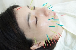 白川美容研究所（中部治療院） 美顔針のメニュー画像