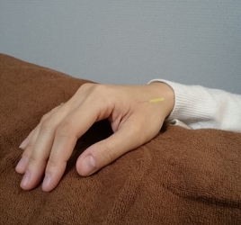 針灸治療院いっきゅう 針灸のみ（大人）のメニュー画像