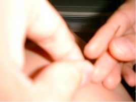 光ヶ丘鍼灸院 施術料　基本のメニュー画像