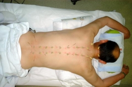 光ヶ丘鍼灸院 施術料　局所のメニュー画像