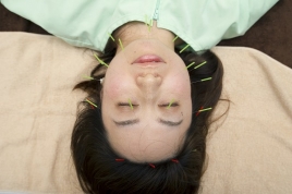 用賀HARU治療院 美容鍼　Beauty Faceのメニュー画像