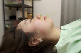 用賀HARU治療院 美容鍼　Happy Lineのメニュー画像