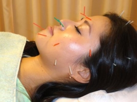 ＮＯＢＵ鍼灸治療院 美容鍼灸総合のメニュー画像