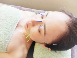 陽なた鍼灸・整骨院 スタンダード美顔鍼のメニュー画像