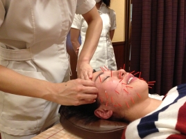 アキュモ鍼灸整体院 筋膜美容鍼灸ベーシックのメニュー画像