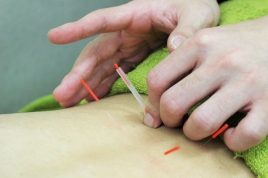 メトロはりきゅう整骨院 はり・灸治療（自費）のメニュー画像