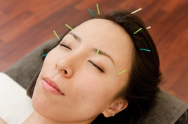 美容鍼灸サロンAria(アリア) 美顔鍼コースのメニュー画像