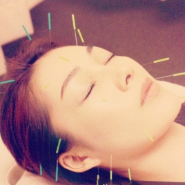 Relaxin' 美容鍼 クイックコースのメニュー画像