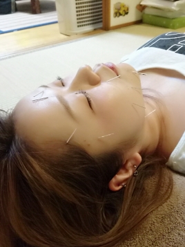 はりきゅう院 HACHI 美容鍼灸のメニュー画像