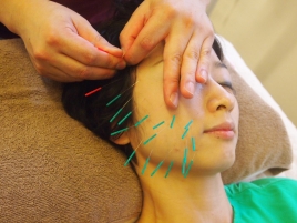 鶴亀堂鍼灸院＆エステティックサロンｍ 美容鍼灸レギュラーコースのメニュー画像