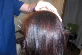 歯やお顔の痛み・しびれのお悩みに　YNSAの紗楽鍼灸院 脳神経疾患のはり施術のメニュー画像