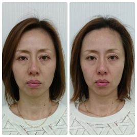 東京高齢不妊センター匠整体院 美小顔鍼灸のメニュー画像