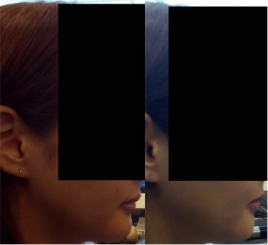 田中鍼灸整骨院 顔の浮腫みのメニュー画像