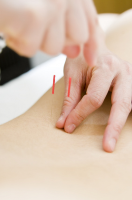 寺町スポーツ治療院 治療のメニュー画像