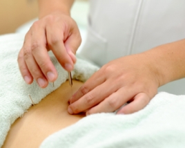 よし鍼灸接骨院（尼崎本院） 鍼治療のメニュー画像